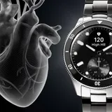 Withings Scanwatch Nova 42mm - Black